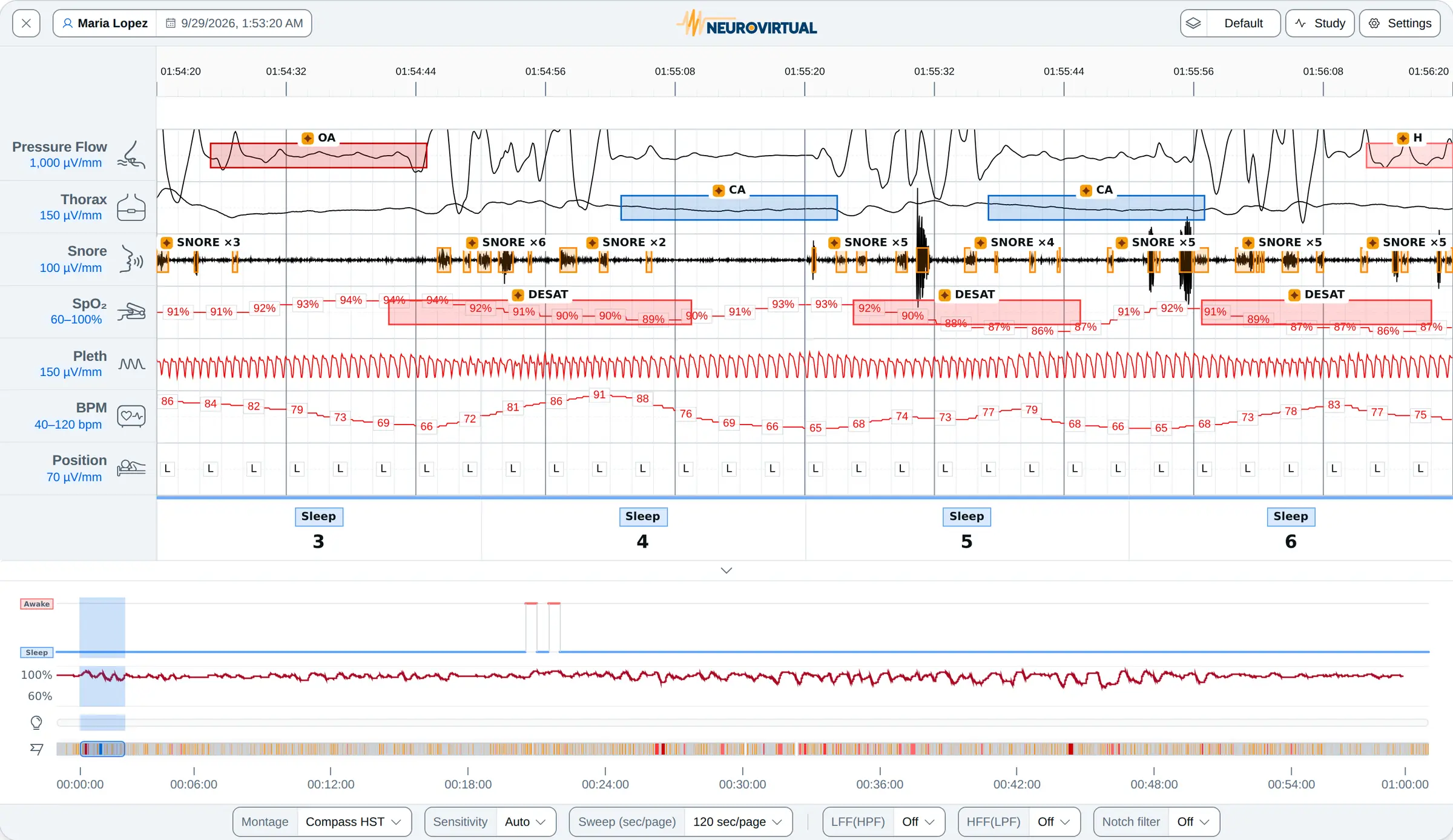 Two minutes of an HST Compass recording in the wave viewer: pressure flow, thoracic effort, snore, SpO₂, pleth, pulse rate and body position, with scored events, the hypnogram and the full-night SpO₂ trend